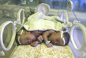 Китайские доктора поделили сиамских близнецов